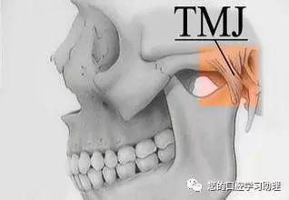 警惕颞下颌关节紊乱症,小毛病会带来大伤害