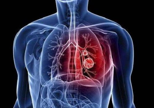 疾病最长潜伏期约14天 国家卫健委发布新版新型肺炎防控方案