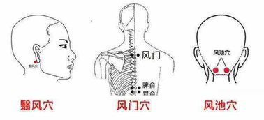 艾灸有效调理头痛一例