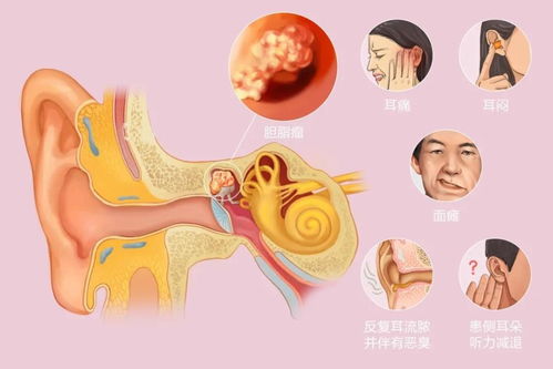 医生眼里善良的6种 瘤 ,查出来别怕,恶化的几率微乎其微