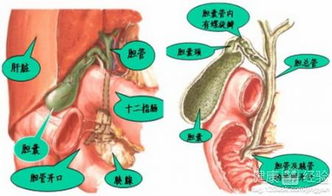 胆囊结石的处理原则