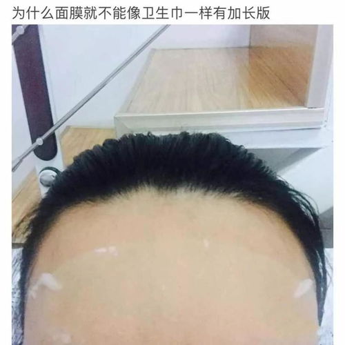 发迹线高凸额头是什么体念,BABY同款刘海来救你