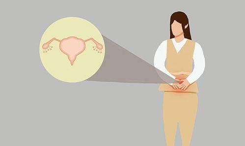 怎么知道子宫肌瘤是良性或恶性