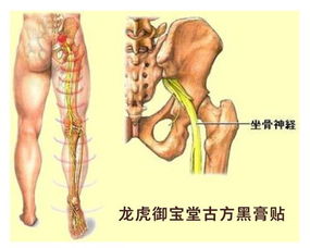 大腿根有的时候突然感觉像针扎了一样,这是坐骨神经痛的征兆吗 