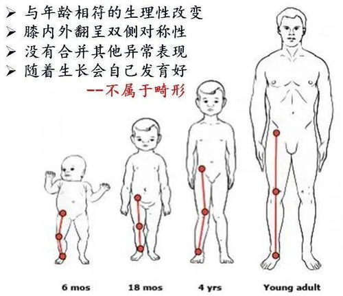 健康一点点 矫正腿型你做错了