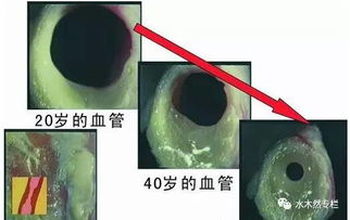 99 的血液病症无征兆,记住这3个字就能让你一生健康 