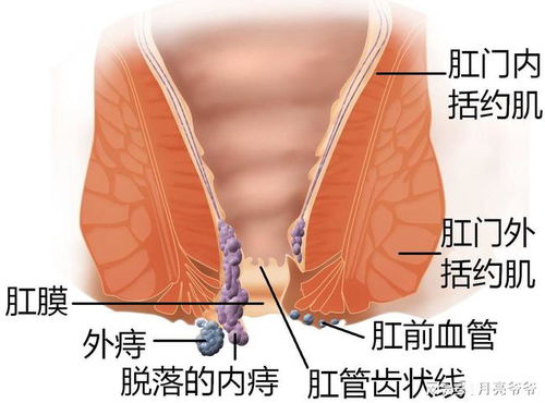 98岁老中医 痔疮严重,就因这味药成功治愈痔疮