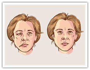 眼皮 面部肌肉跳动可能是颅内面神经的问题