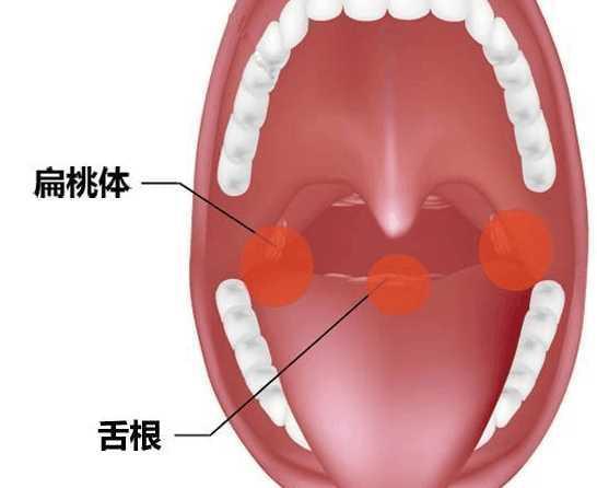 骨头卡在喉咙图片 搜狗图片搜索