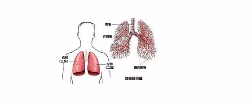 肺癌脑转移出现中枢神经系统症状的救治方案