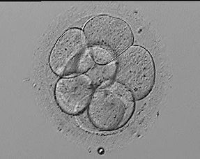 试管婴儿胚胎移植知多D