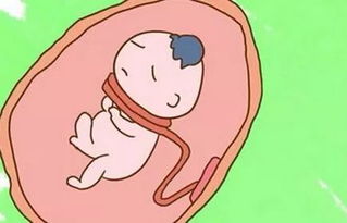 原创孕期，宝妈这个“感觉”，别总觉得正常，可能是宝宝“脐带绕颈”