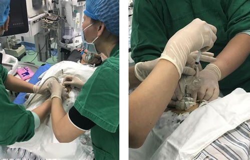 云南省妇幼保健院开展首例胎儿脐血管穿刺产前诊断工作圆满成功