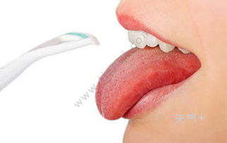 舌苔厚白是疾病的征兆吗 舌苔厚白是什么原因