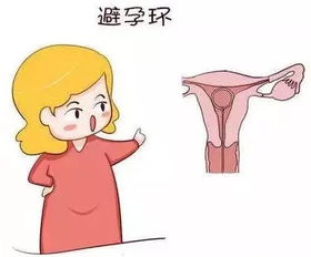 女性取环后,为什么还会不孕