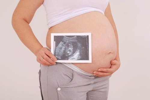 表情 怀孕39周,胎儿双顶径10厘米,能顺产吗 胎儿 顺产 孕妇 新浪网 表情 
