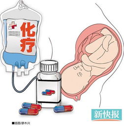 乳腺癌化疗和靶向治疗 临沂乳腺癌化疗放疗靶向新农合报销完大约得多少钱 