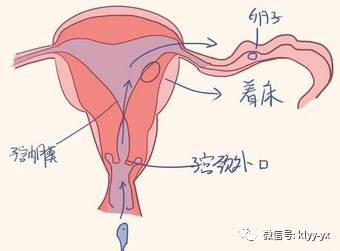 备孕二胎, 取环 的各种问题您有吗 