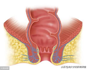 难言之痒,不能一搔了之 一文了解肛门瘙痒的原因和处理