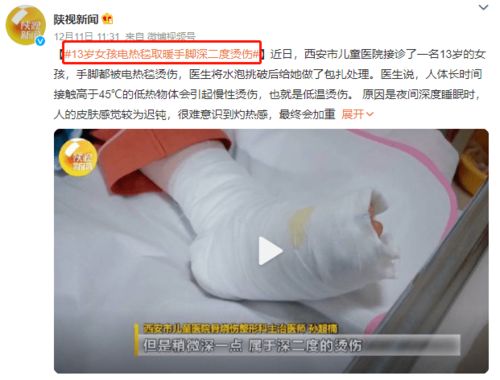 不就是贴个暖宝宝吗,怎么就烫伤了