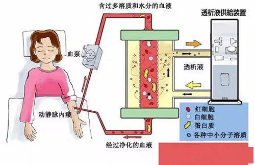 什么是 透析充分性