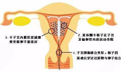 上环的最佳时间(女性上环的最佳时间)