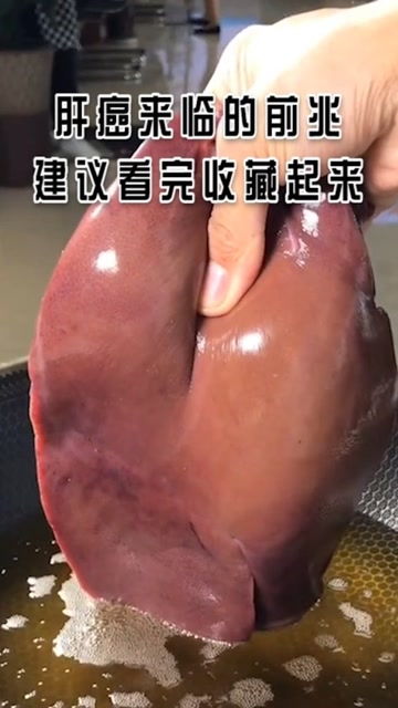 肝癌来临的前兆,建议看完收藏起来 