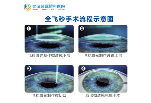 icl晶体植入和飞秒激光近视手术哪个好 武汉普瑞眼科医院建议适合自己的更好