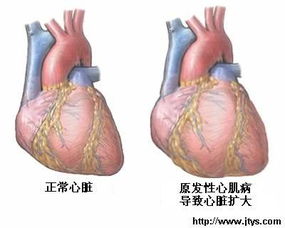 心血管外科手术.心脏移植术.手术适应症 图库中心 