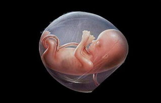 生死时速！怀孕8个多月，胎儿脐带绕颈，孕妇子痫！