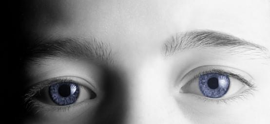 全世界只有4万人 他们的眼睛不同色, 蓝色眼眸让他们很苦恼