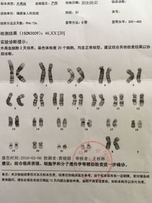 结息是什么为什么我的银行钱会增多少0.52元