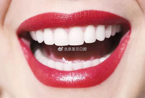 北京圣贝科普 牙齿美白有方法 这三种靠谱方式想不白都难