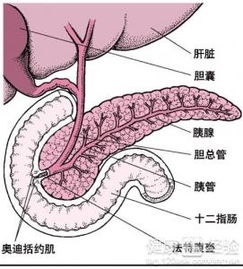 胆原性急性胰腺炎是怎么回事