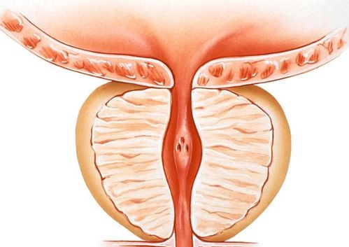 前列腺癌的 克星 找到了,不是番茄,可劲吃,前列腺疾病统统扫除 男性 