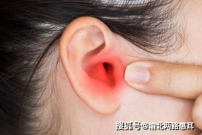 耳朵痒会影响听力吗 哪些情况需要重视