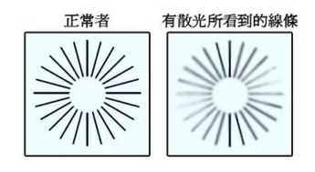 散光 从何而来,又该如何解决