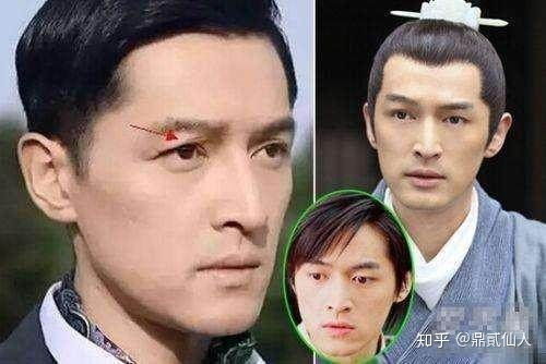 对于男生整容,大家怎么看 