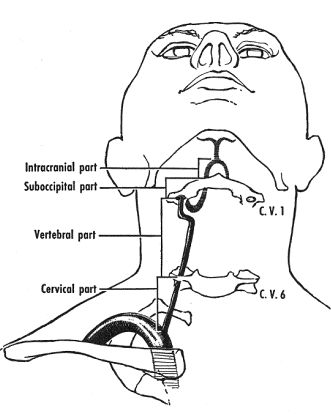 椎动脉5段法解剖图图片