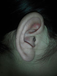 这个耳朵打耳洞会破坏运气吗 