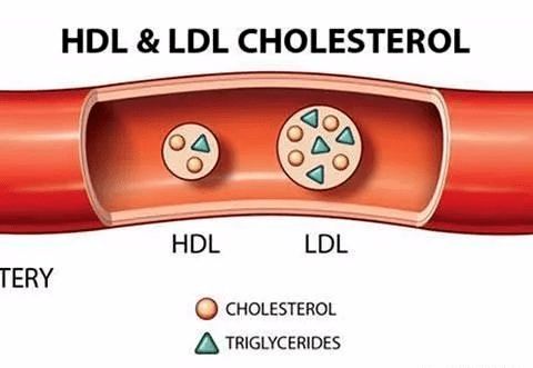 胆固醇升高危害大,当心这4种症状出现,请仔细对照