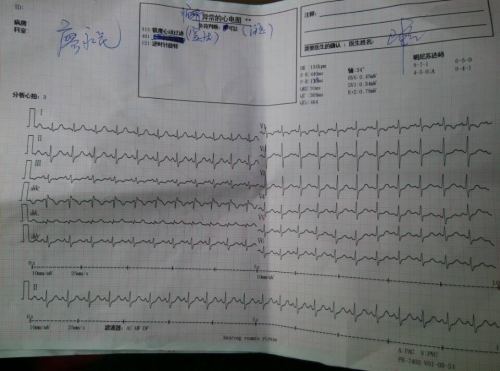 请问里面有医生嘛,这是我老婆怀孕8个月做的心电图,医生说很严重要住院 
