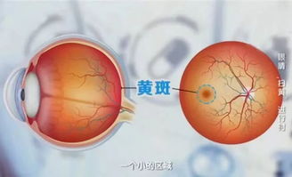 视力模糊,易疲劳 可能是这些疾病的征兆,喀什人千万别忽视了
