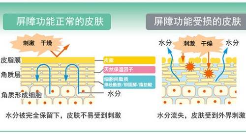 在冬天用热水洗脸,皮肤会发生什么后果