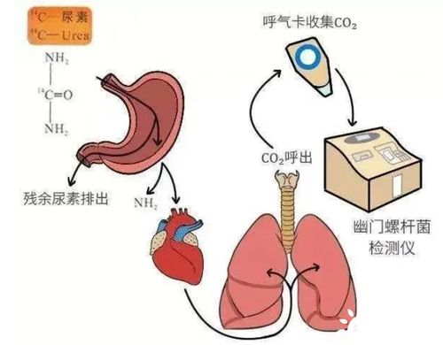 碳封存 碳医疗 碳纤维 你不知道的碳常识都在这里