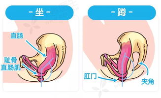 科普一分钟 蹲着排便和坐着排便哪个好