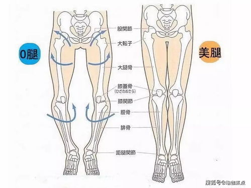 练瑜伽,什么是 X O 型腿 如何矫正 收藏级