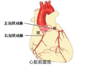 冠状窦和冠状动脉窦一样吗 冠状动脉起自冠状窦为什么不对啊 