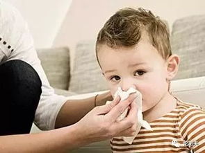 改善宝宝过敏性鼻炎,2种饮食要少碰 症状 