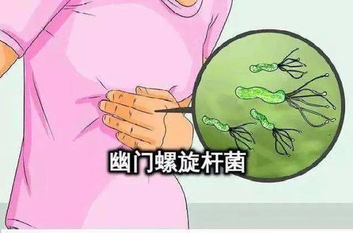 可防可控的胃肠道癌 这些干货请收好.....